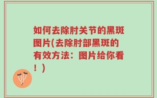 如何去除肘关节的黑斑图片(去除肘部黑斑的有效方法：图片给你看！)