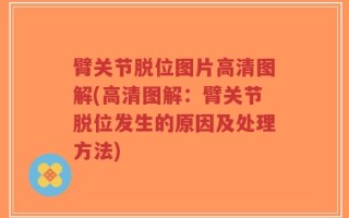 臂关节脱位图片高清图解(高清图解：臂关节脱位发生的原因及处理方法)