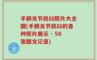 手腕关节脱臼照片大全图(手腕关节脱臼的各种照片展示 - 50张图文记录)