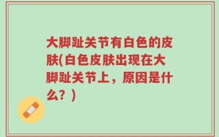 大脚趾关节有白色的皮肤(白色皮肤出现在大脚趾关节上，原因是什么？)
