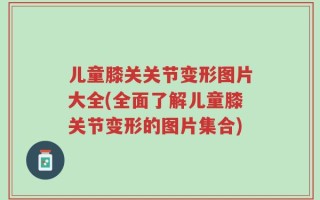 儿童膝关关节变形图片大全(全面了解儿童膝关节变形的图片集合)