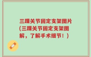 三踝关节固定支架图片(三踝关节固定支架图解，了解手术细节！)