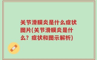 关节滑膜炎是什么症状图片(关节滑膜炎是什么？症状和图示解析)