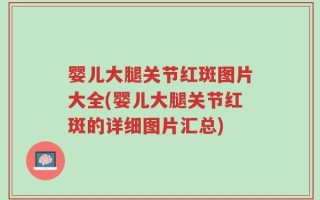 婴儿大腿关节红斑图片大全(婴儿大腿关节红斑的详细图片汇总)