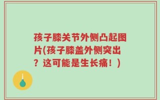 孩子膝关节外侧凸起图片(孩子膝盖外侧突出？这可能是生长痛！)