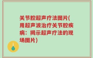 关节腔超声疗法图片(用超声波治疗关节腔疾病：揭示超声疗法的现场图片)