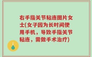 右手指关节粘连图片女士(女子因为长时间使用手机，导致手指关节粘连，需做手术治疗)