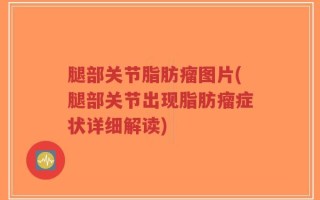 腿部关节脂肪瘤图片(腿部关节出现脂肪瘤症状详细解读)