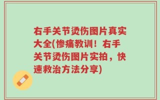 右手关节烫伤图片真实大全(惨痛教训！右手关节烫伤图片实拍，快速救治方法分享)