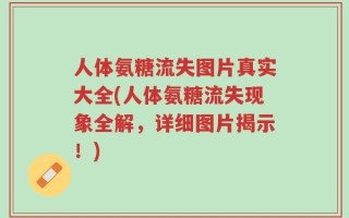 人体氨糖流失图片真实大全(人体氨糖流失现象全解，详细图片揭示！)