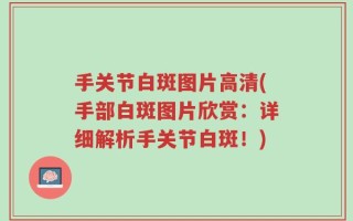 手关节白斑图片高清(手部白斑图片欣赏：详细解析手关节白斑！)