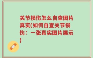 关节损伤怎么自查图片真实(如何自查关节损伤：一张真实图片展示)