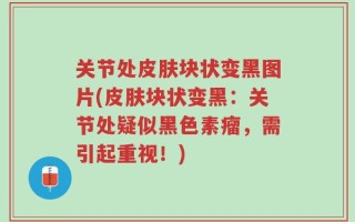 关节处皮肤块状变黑图片(皮肤块状变黑：关节处疑似黑色素瘤，需引起重视！)