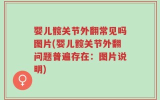 婴儿髋关节外翻常见吗图片(婴儿髋关节外翻问题普遍存在：图片说明)