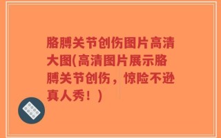 胳膊关节创伤图片高清大图(高清图片展示胳膊关节创伤，惊险不逊真人秀！)