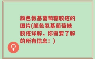 颜色氨基葡萄糖胶疮的图片(颜色氨基葡萄糖胶疮详解，你需要了解的所有信息！)
