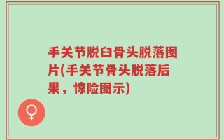 手关节脱臼骨头脱落图片(手关节骨头脱落后果，惊险图示)