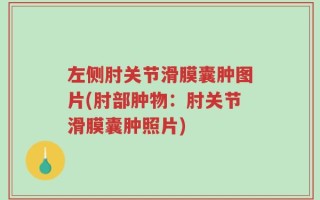 左侧肘关节滑膜囊肿图片(肘部肿物：肘关节滑膜囊肿照片)