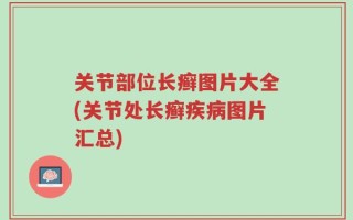 关节部位长癣图片大全(关节处长癣疾病图片汇总)