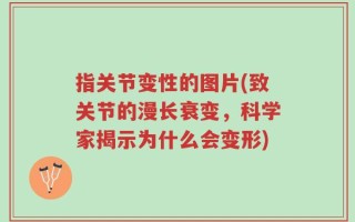 指关节变性的图片(致关节的漫长衰变，科学家揭示为什么会变形)