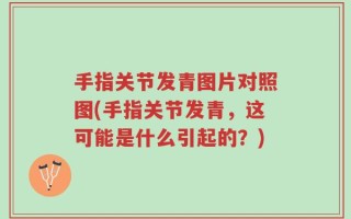 手指关节发青图片对照图(手指关节发青，这可能是什么引起的？)