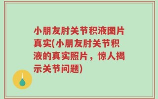 小朋友肘关节积液图片真实(小朋友肘关节积液的真实照片，惊人揭示关节问题)