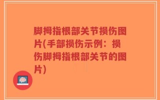 脚拇指根部关节损伤图片(手部损伤示例：损伤脚拇指根部关节的图片)
