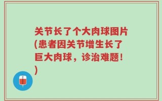 关节长了个大肉球图片(患者因关节增生长了巨大肉球，诊治难题！)
