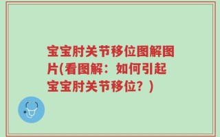 宝宝肘关节移位图解图片(看图解：如何引起宝宝肘关节移位？)