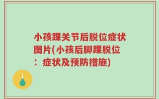 小孩踝关节后脱位症状图片(小孩后脚踝脱位：症状及预防措施)