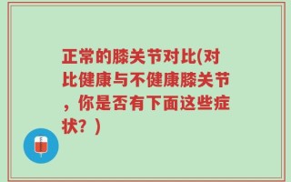正常的膝关节对比(对比健康与不健康膝关节，你是否有下面这些症状？)