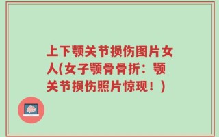 上下颚关节损伤图片女人(女子颚骨骨折：颚关节损伤照片惊现！)