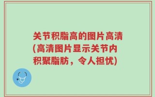 关节积脂高的图片高清(高清图片显示关节内积聚脂肪，令人担忧)