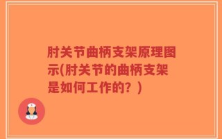 肘关节曲柄支架原理图示(肘关节的曲柄支架是如何工作的？)