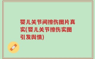 婴儿关节间擦伤图片真实(婴儿关节擦伤实图引发舆情)