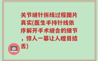关节缝针拆线过程图片真实(医生手持针线依序解开手术缝合的细节，惊人一幕让人瞠目结舌)