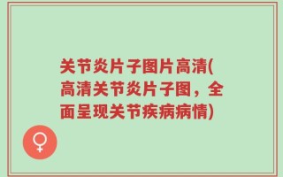 关节炎片子图片高清(高清关节炎片子图，全面呈现关节疾病病情)