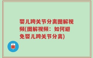 婴儿跨关节分离图解视频(图解视频：如何避免婴儿跨关节分离)