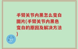 手臂关节内黑怎么变白图片(手臂关节内黑色变白的原因及解决方法)