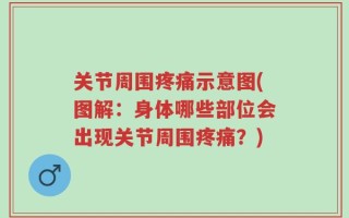 关节周围疼痛示意图(图解：身体哪些部位会出现关节周围疼痛？)