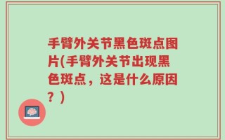 手臂外关节黑色斑点图片(手臂外关节出现黑色斑点，这是什么原因？)