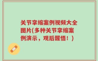 关节挛缩案例视频大全图片(多种关节挛缩案例演示，观后醒悟！)