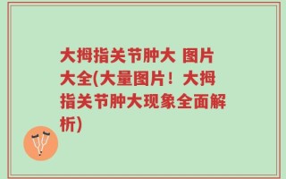大拇指关节肿大 图片大全(大量图片！大拇指关节肿大现象全面解析)