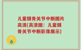 儿童髁骨关节中断图片高清(高清图：儿童髁骨关节中断影像展示)