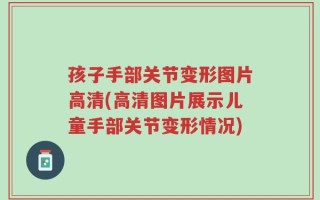 孩子手部关节变形图片高清(高清图片展示儿童手部关节变形情况)