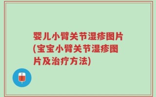 婴儿小臂关节湿疹图片(宝宝小臂关节湿疹图片及治疗方法)