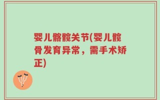 婴儿髂髋关节(婴儿髋骨发育异常，需手术矫正)