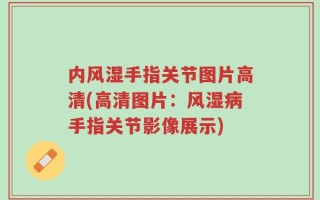 内风湿手指关节图片高清(高清图片：风湿病手指关节影像展示)