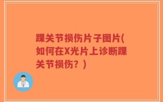 踝关节损伤片子图片(如何在X光片上诊断踝关节损伤？)