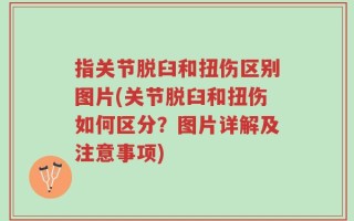 指关节脱臼和扭伤区别图片(关节脱臼和扭伤如何区分？图片详解及注意事项)